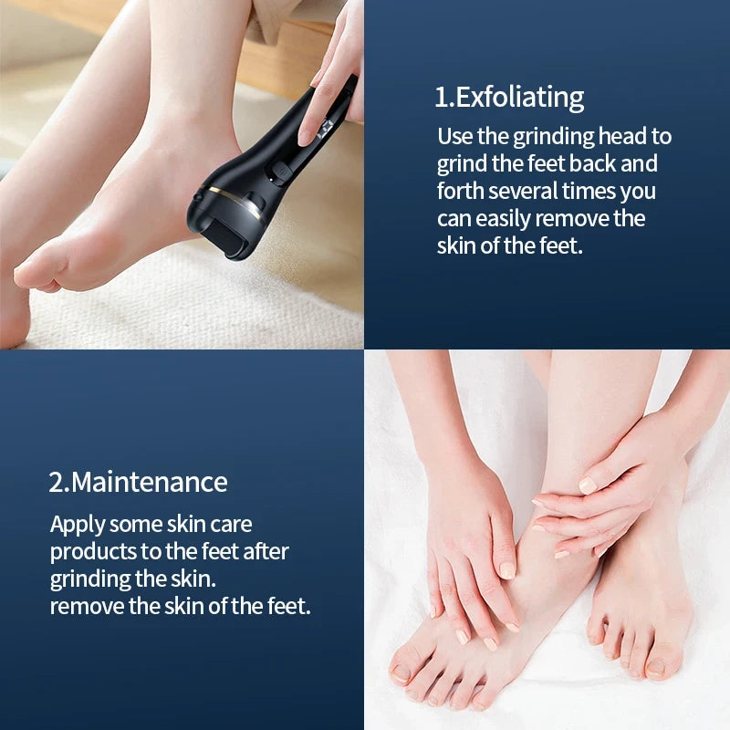 Rechargeable Electric Foot Grinder