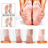 Electric Foot Callus Remover