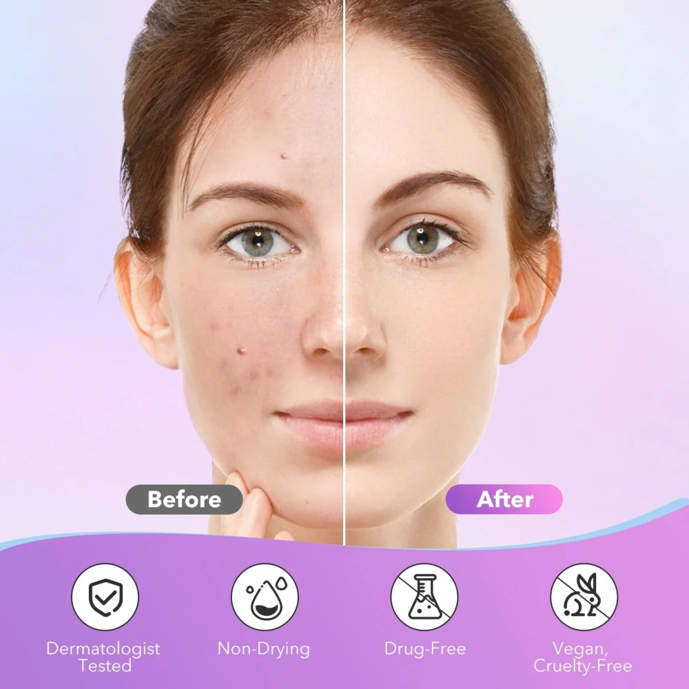 Colorful Star Pimple Patches