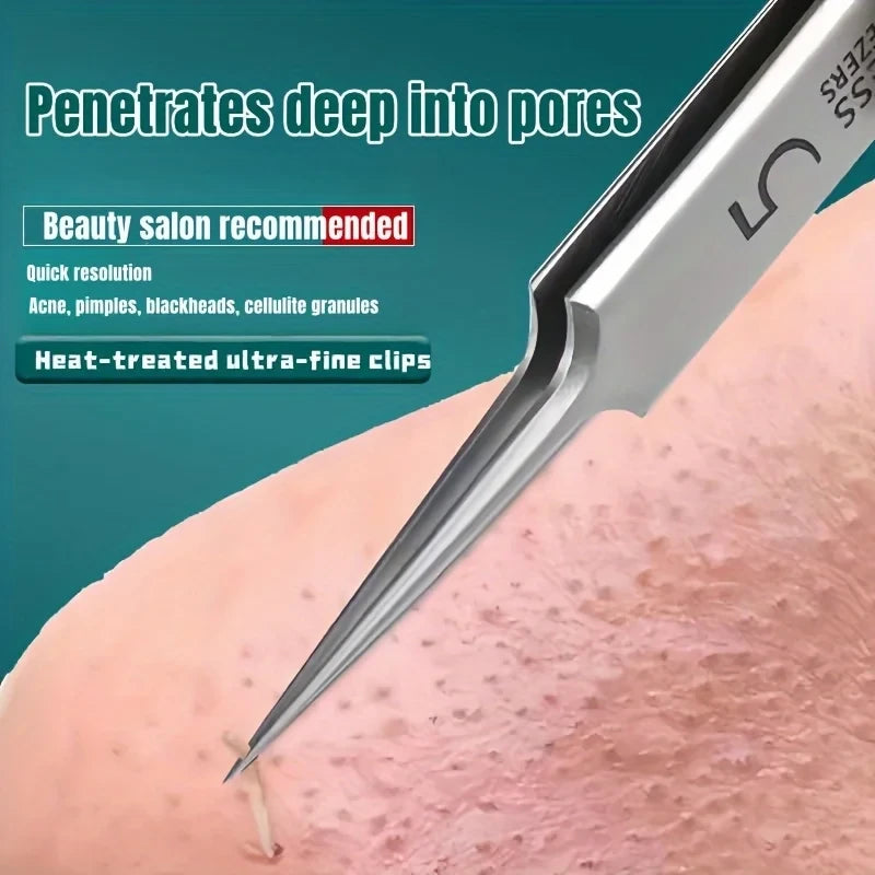 Stainless Steel Blackhead Removal Tweezer