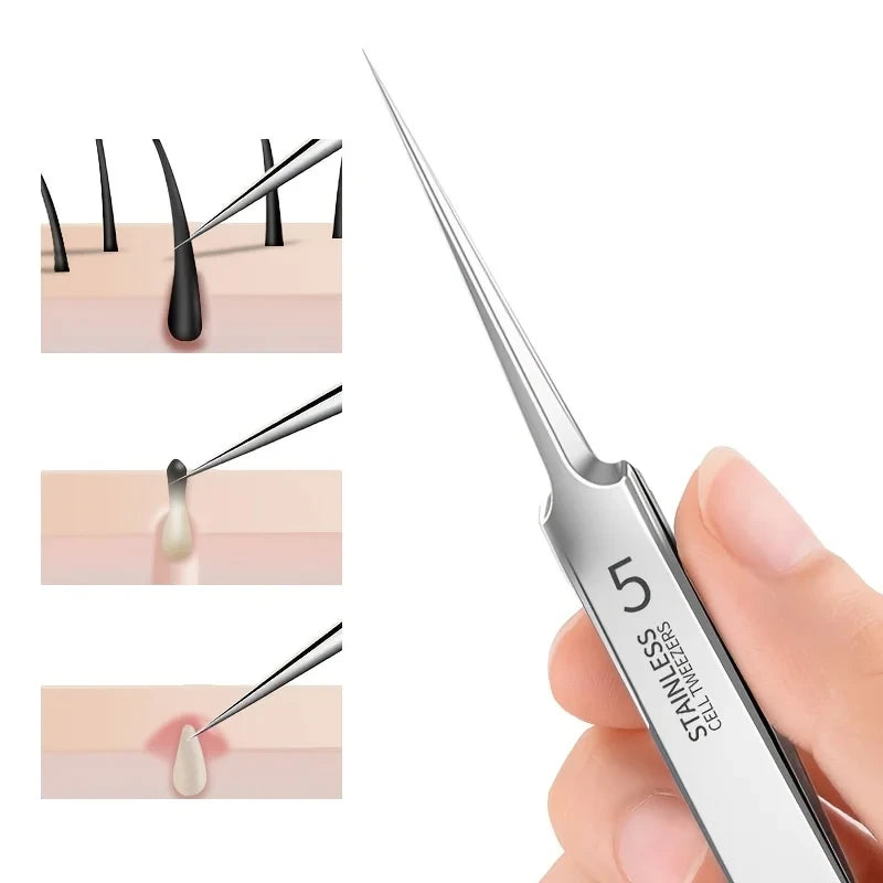 Stainless Steel Blackhead Removal Tweezer
