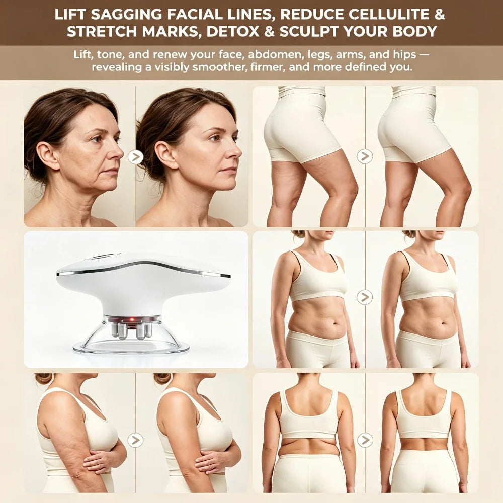 Electric Cupping Massager with Red Light Therapy